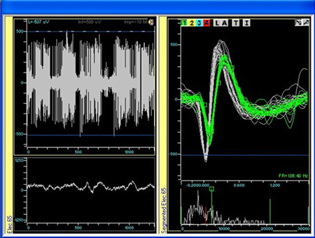 生理信号记录分析系统